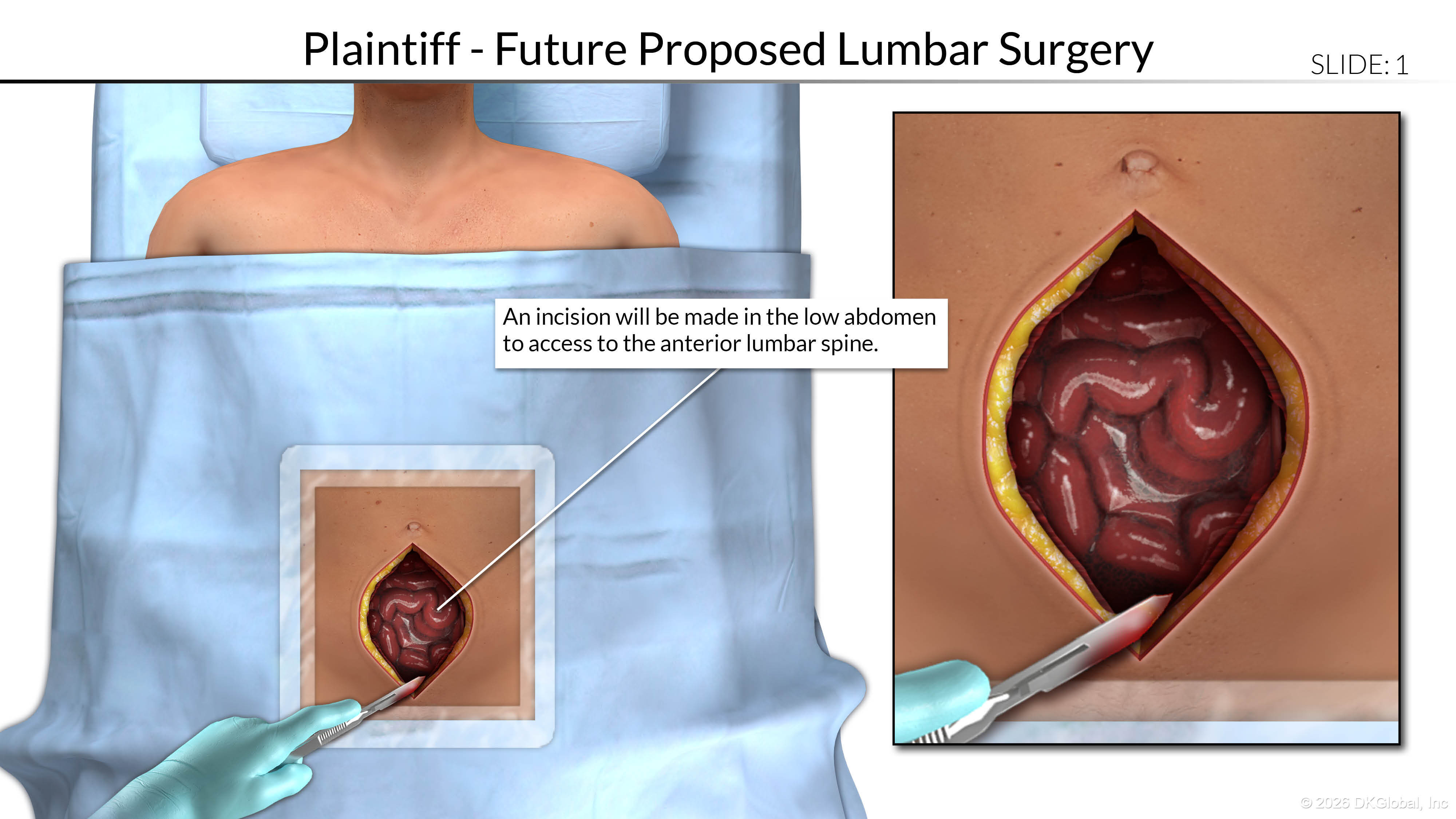 Injury Diagram